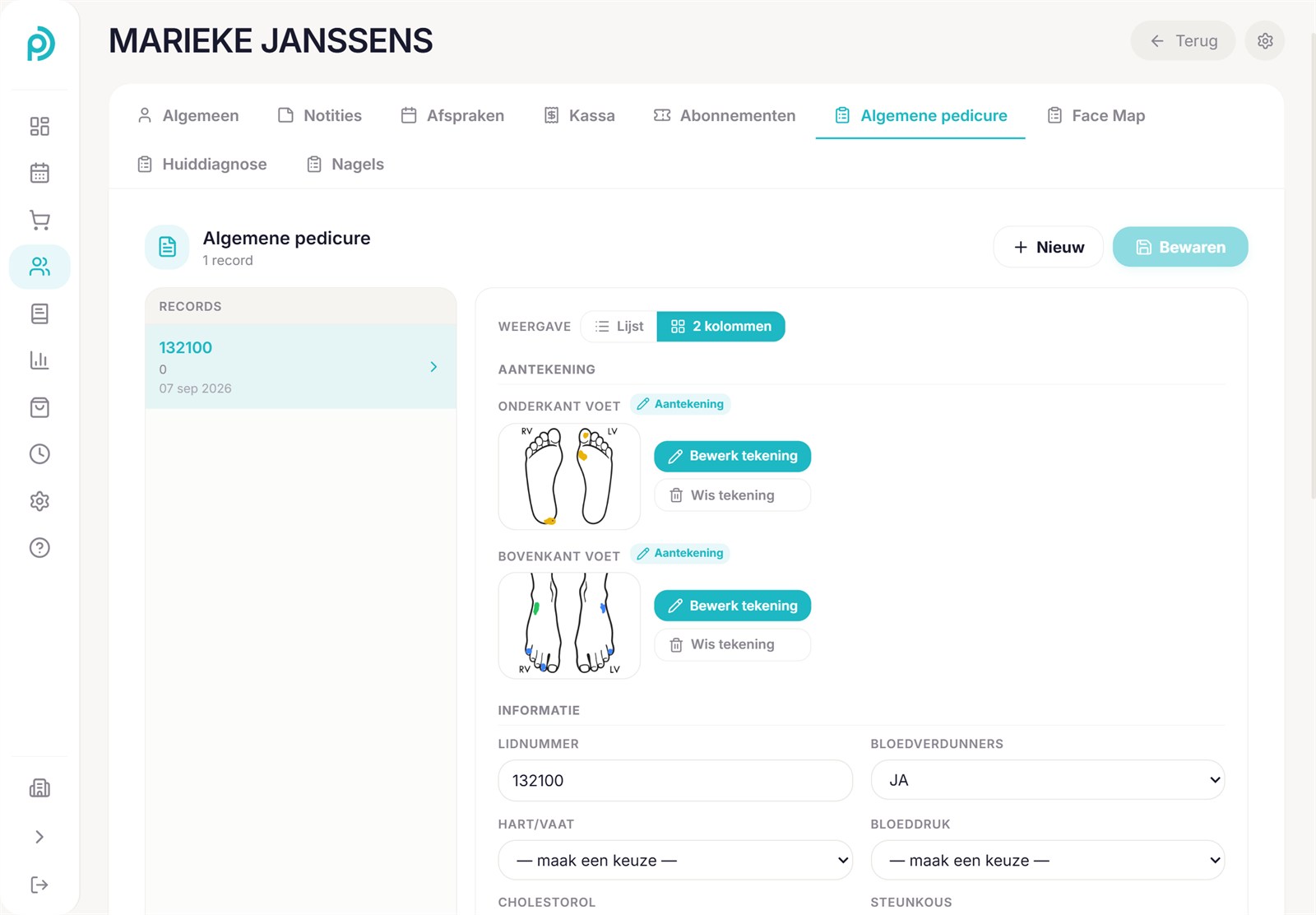 Het voetformulier in Posworld op een tablet: tekeningen van de onder- en bovenkant van beide voeten met gekleurde aanduidingen, met daaronder velden voor lidnummer, bloedverdunners, hart en vaten en bloeddruk.